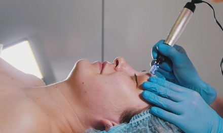 1 sesion de exosomas con dermapen  en rostro completo con limpieza facial - Estética Integral JNS