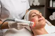 One, Two, or Three Non-Invasive Face Lift with Therma Lift Radio-Frequency Skin Tightening (Up To 55% Off) - Second Medium