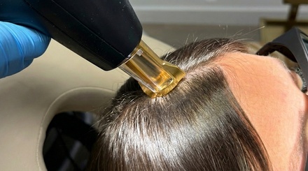 Three FoLix Laser Hair Restoration Treatment Sessions (3 Monthly Sessions) - Hairthetics