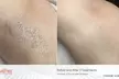Up to 53% Off Eight Laser Hair Removal Sessions for XS to XL Area at Lotus Health & Aesthetics Spa - Second Medium