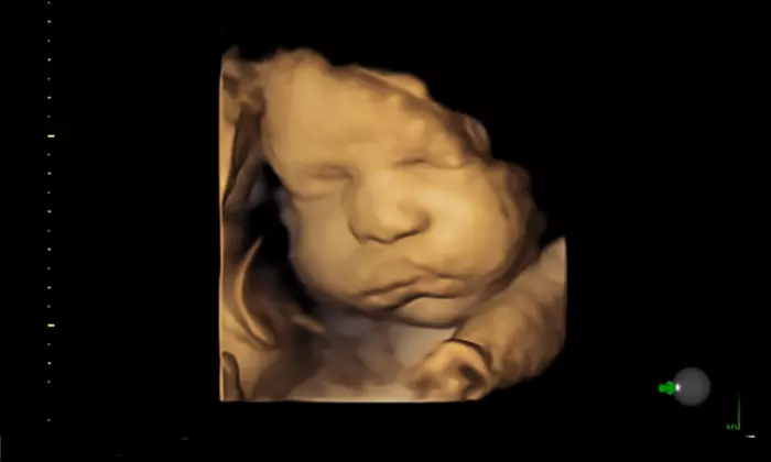 Capture Baby's First Moments with 3D/4D Ultrasound