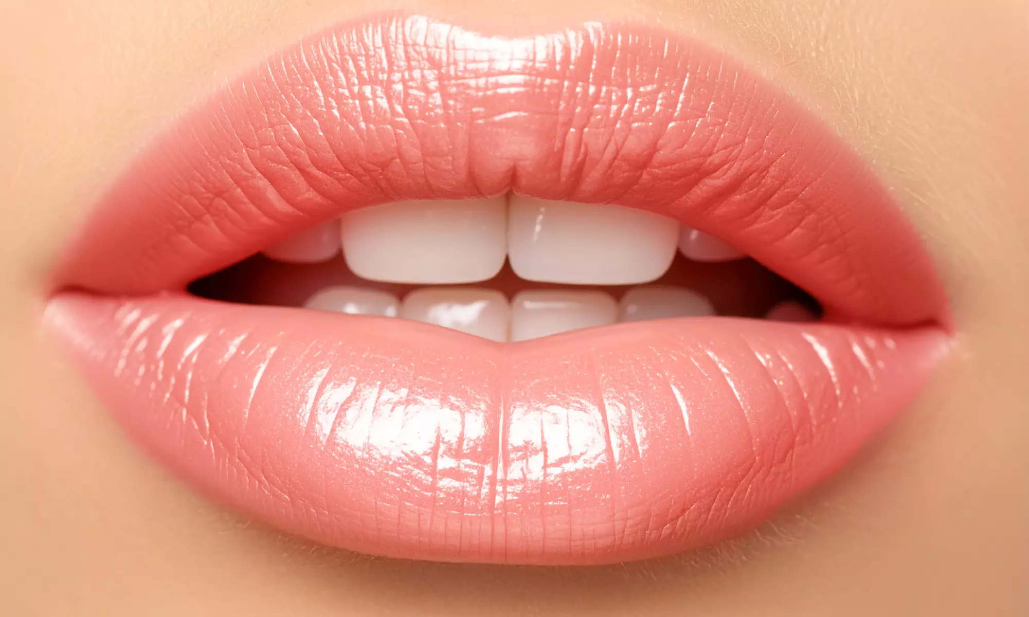 Lip Enhancement with 0.5ml or 1ml Options by National Aesthetics Clinic at 4 Melbourne Locations (Up To 34% Off) - Primary Image