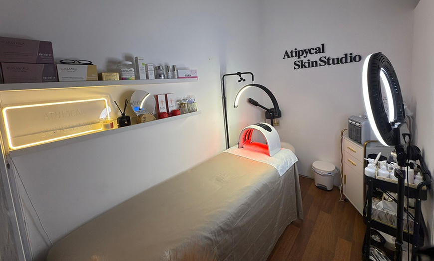 Image 1: Limpieza facial con Glass skin, dermapen o cóctel Skin booster