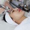 Image 1: Revitalize with One or Two Sessions Deluxe Microneedling - Face & Neck