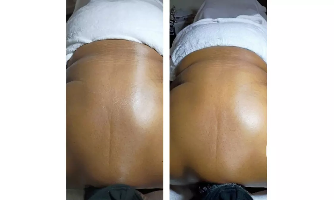 Revitalize with One or Two 45-Min Hydrating or Deep Cleaning Facials