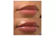 One Syringe of Juvederm Ultra or Juvederm Ultra Plus at Spa Bella Medispa (Up to 43% Off) - Second Medium