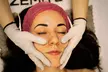 60-Minute 1, 3, or 5x Cold Plasma Facial (Acne or Anti-Aging) at Beauty Wellness CHI (Up to 67% Off) - Second Medium
