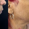 Image 2: Enhance beauty with comprehensive aesthetic services at Bekheit Care