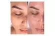 Rejuvenate w/ Hydrafacial with Peel-Off Mask, LED Therapy, & Dermaplaning or Double the Treatment (Up to 53%Off) - Second Medium