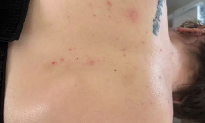 Revitalize Your Look w/ One, Three or Five Oxygen Clarifying Facials