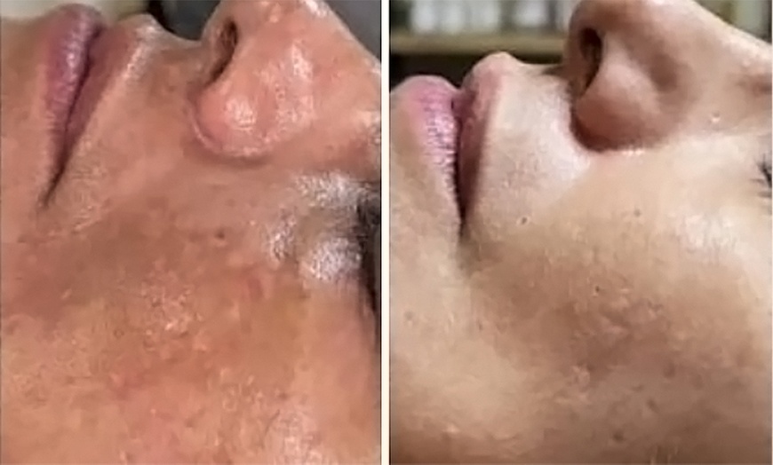 Image 5: Experience a Japanese Head Spa with Halo Water and a Mini Facial