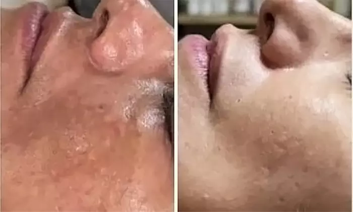 Experience a Japanese Head Spa with Halo Water and a Mini Facial