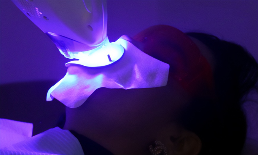Image 2: Zoom Teeth Whitening: 30- or 60-Minute Sessions with Exam & Cleaning