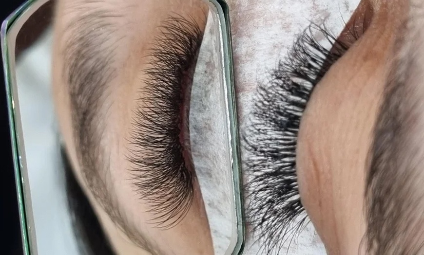 Image 5: Microneedling et peeling d'1h