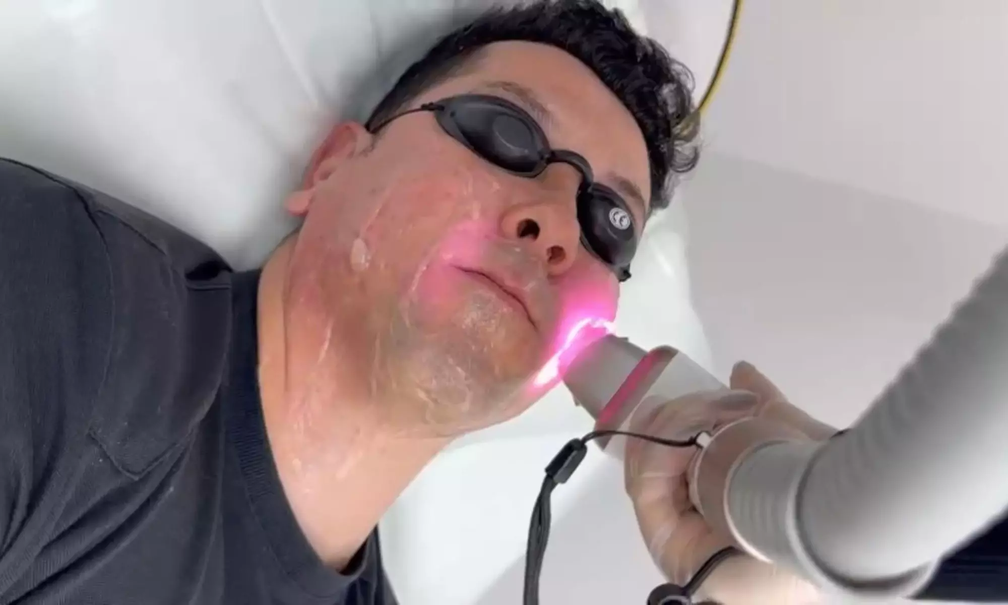 Up to 83% Off on Laser Hair Removal at HL Lasers