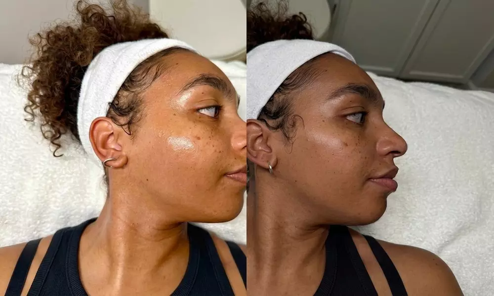 60-Minute Relaxing Facial or Premium Facial with Complimentary Abdominal Line Sugaring (Up to 25% Off) - Primary Image