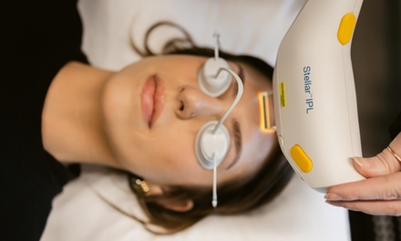 One Full Face IPL Photo Facial - ProSkin Esthetics and Laser - Lakeville