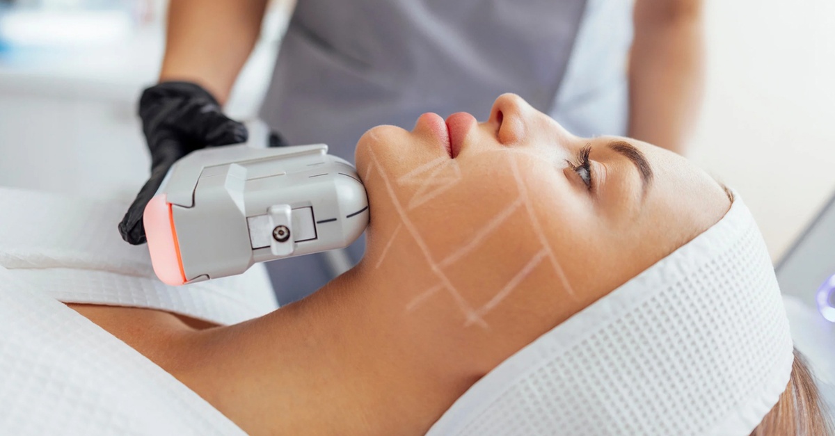 Tratamiento HIFU con radiofrecuencia en Barcelona