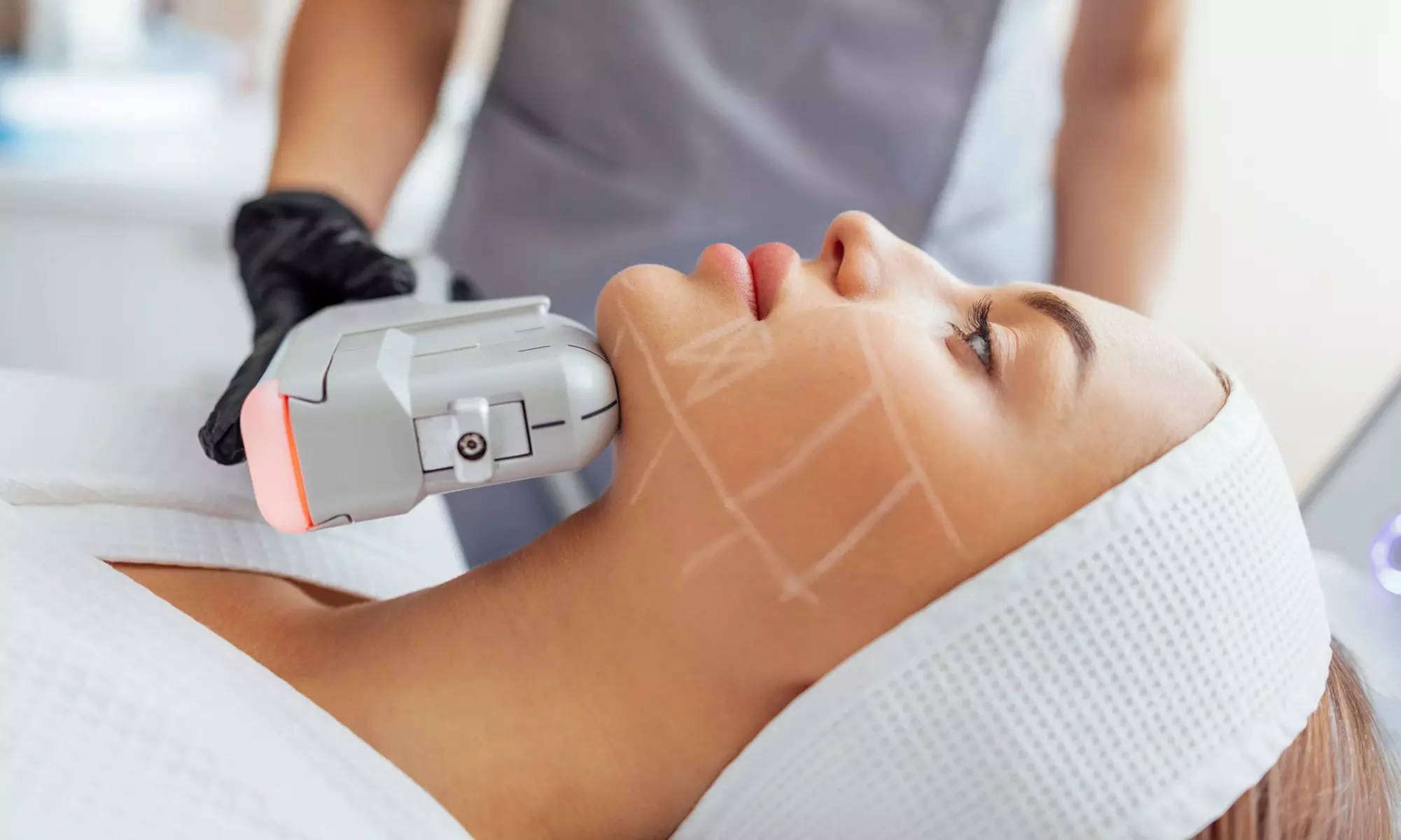 Tratamiento HIFU en zona a elegir con radiofrecuencia para 1 persona, ahorra hasta un 70% - Primary Image