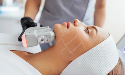 Tratamiento HIFU rostro completo con radiofrecuencia para 1 persona - BELLANOVA