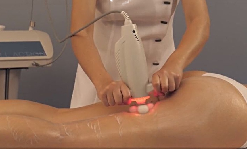 Image 11: 3 o 6 sesiones de combo reductor o remodelante con presoterapia y más