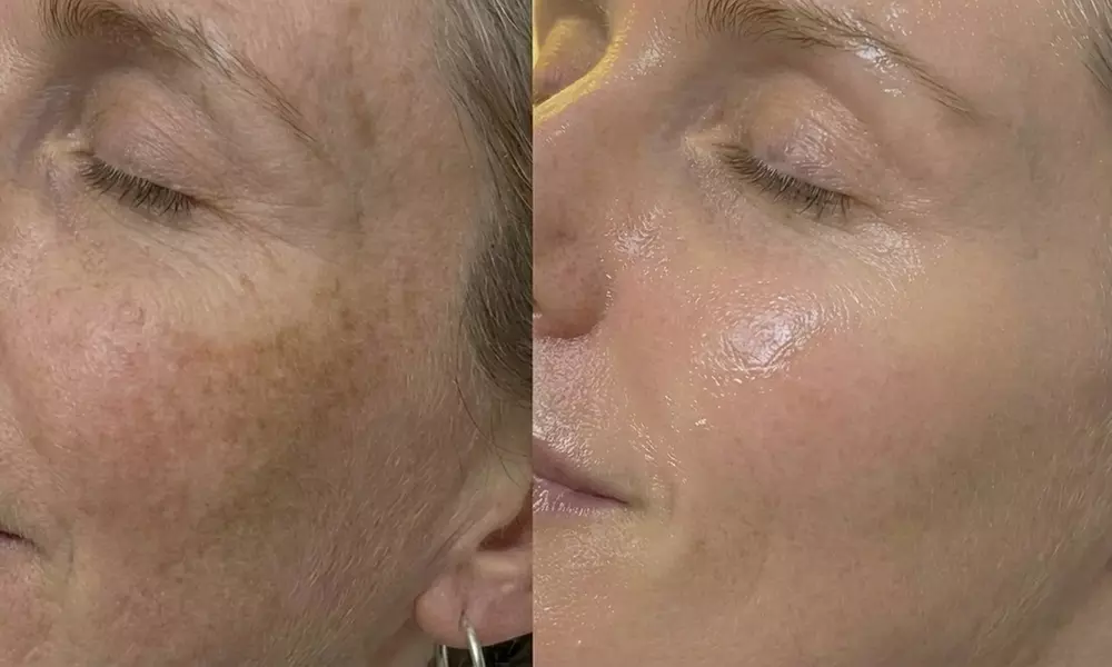 Unifiez votre teint avec un soin anti-taches ciblé 5G Removal