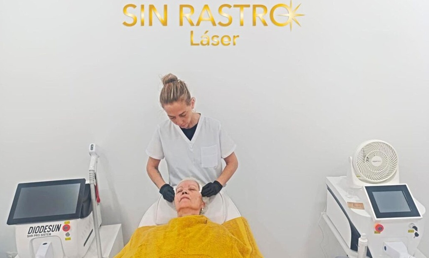 Image 2: 1, 3 o 6 sesiones de depilación con láser SHR para 1 persona