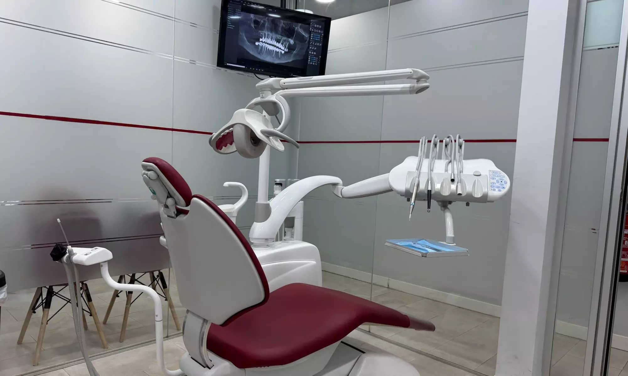 Limpieza con ultrasonidos, revisión y pulido y blanqueamento opcional