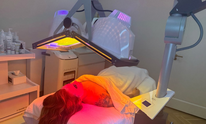 Image 5: Haren op de verkeerde plek? Laser ze naar een andere dimensie