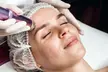 Higiene facial con opción a radiofrecuencia, microdermoabrasión, LED y masaje para 1; ahorra hasta un 71% - Second Medium