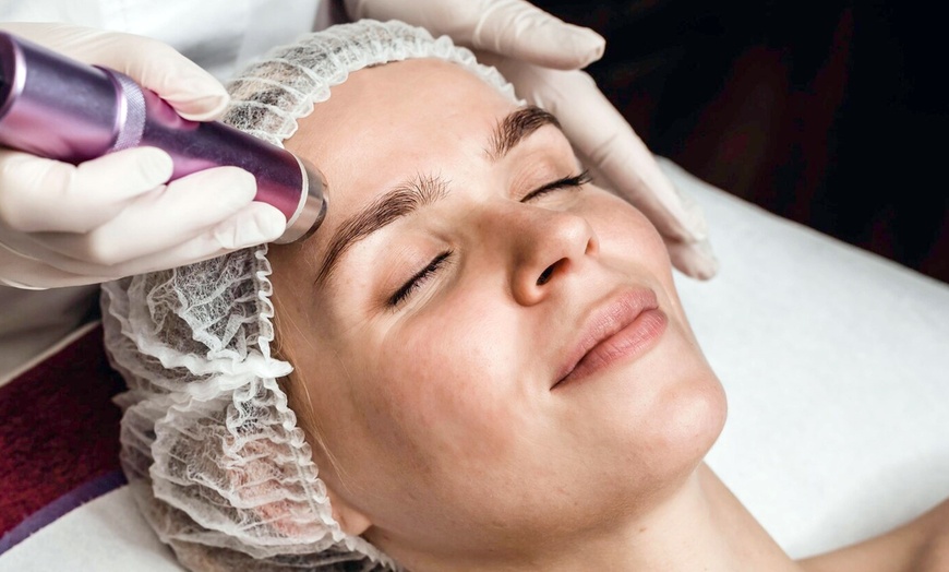Image 4: Higiene facial con radiofrecuencia, microdermoabrasión, LED y masaje
