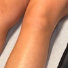 Image 7: Up to 55% Off on Brazilian / Bikini Waxing at BARE AND SMOOTH ESTHETICS LLC