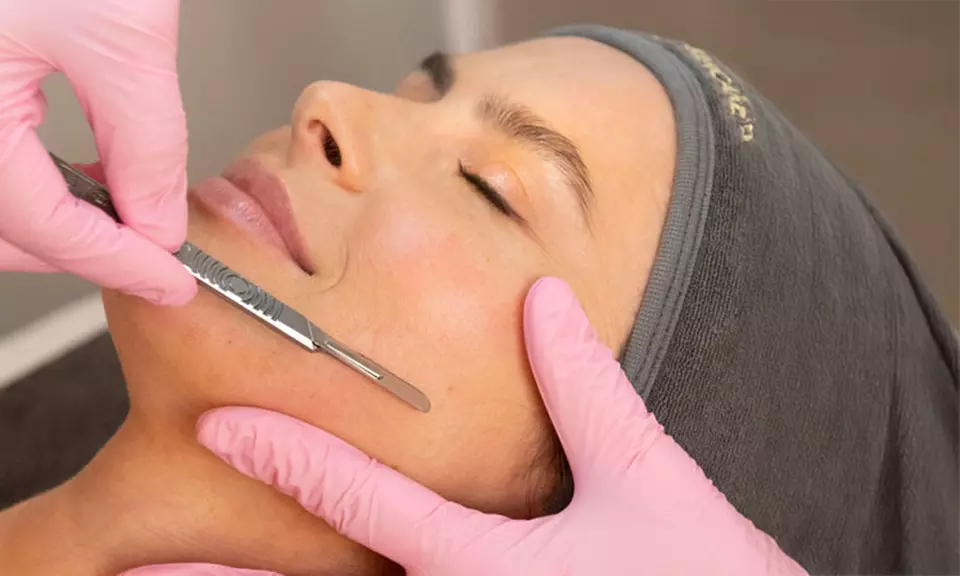 Enhance Your Look with 1, 3, or 5 Sessions of 60-Minute Chemical Peel