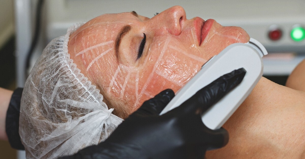 Refresh with a HIFU Full Face Treatment with Optional Neck Treatment