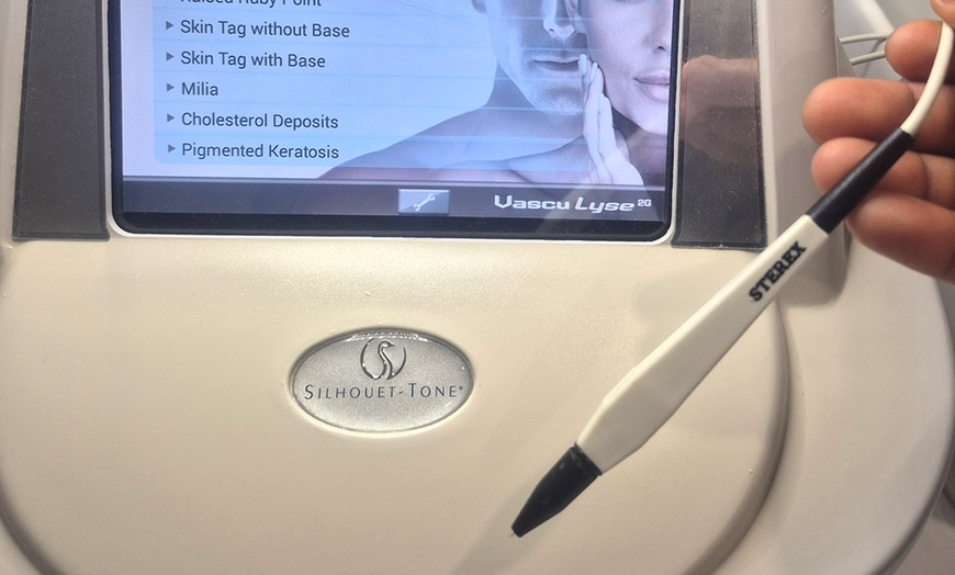 Image 3: Achieve Flawless Look with Full Face or Neck Tag Removal