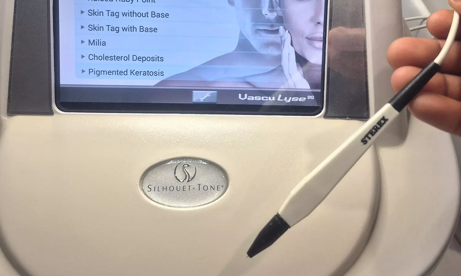 Achieve Flawless Look with Full Face or Neck Tag Removal at Elite Medical Aesthetics Clinic (Up to 52% Off) - Second Medium