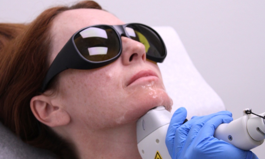 Image 2: Six laser hair removal treatments at various locations