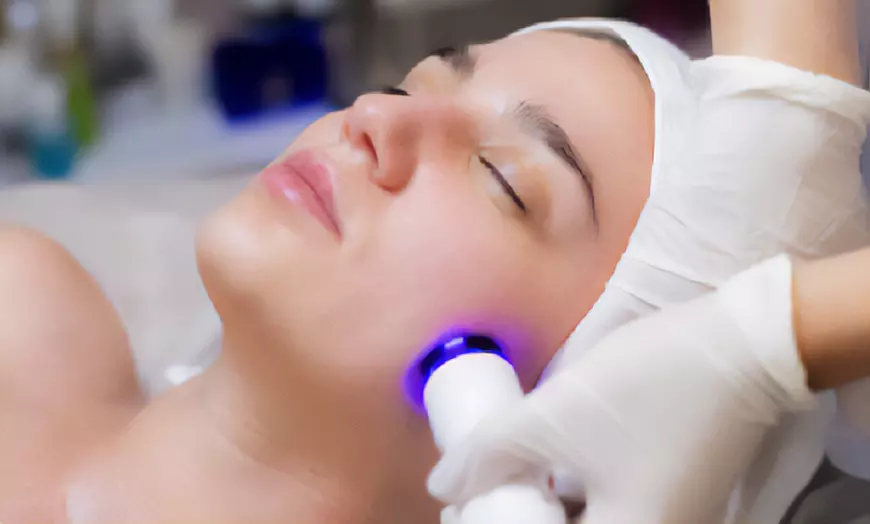 Image 2: 1, 2 o 3 sesiones de radiofrecuencia facial con opción a presoterapia 