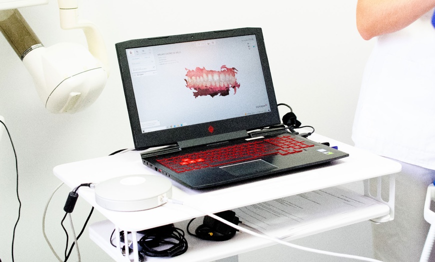 Image 3: Limpieza dental y blanqueamiento