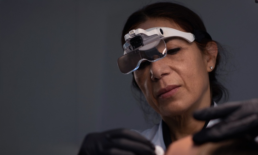 Image 3: Luxe Belotero Balance fillers met consultt voor een frisse uitstraling