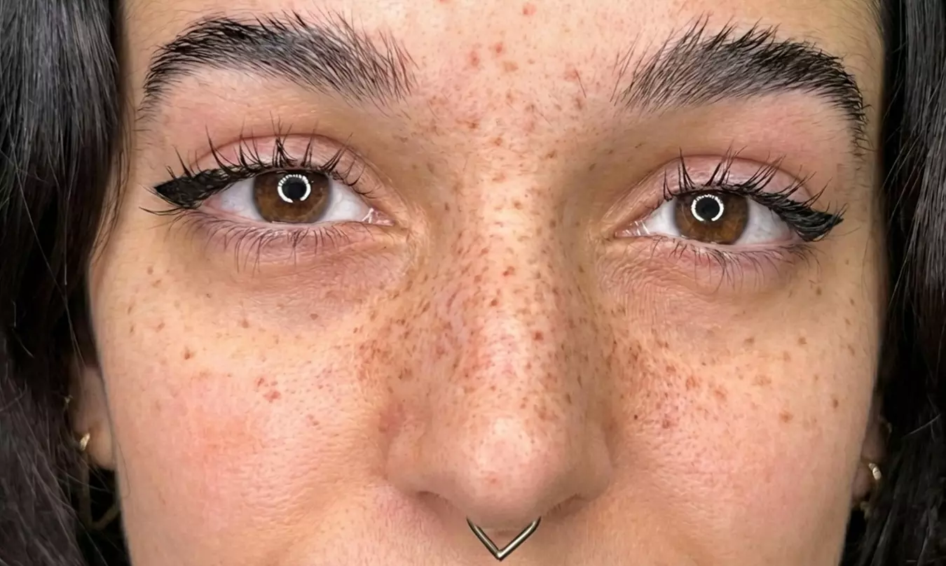 Sesión de micropigmentación de lunares o pecas por tallas XS a XL