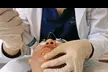 One or Three PicoWay Laser Resolve Skin Resurfacing Face Treatments at SlimmThicc Aesthetics Spa (Up to 65% Off) - Second Medium