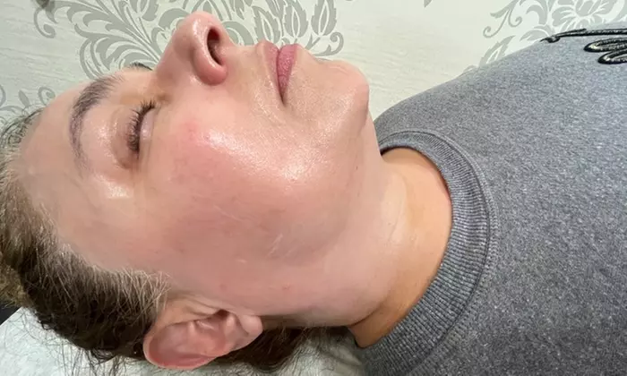 Achieve Radiant Skin with Aero Laser and Skin's Dermaplaning and More Options Up to 55% Off - Primary Image