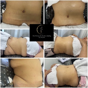 60-Min Targeted Lymphatic Massage with Radio Frequency for Detox & Toning + Free Belly Wrap - The House Of Body Sculpting
