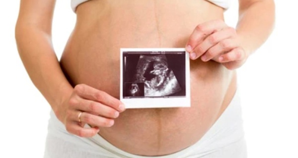 Up to 35% Off on Ultrasound - 3D / 4D at TOP SUPPLY Precious Glimpse