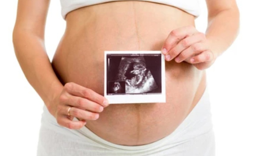 Image 1: Up to 35% Off on Ultrasound - 3D / 4D at TOP SUPPLY Precious Glimpse