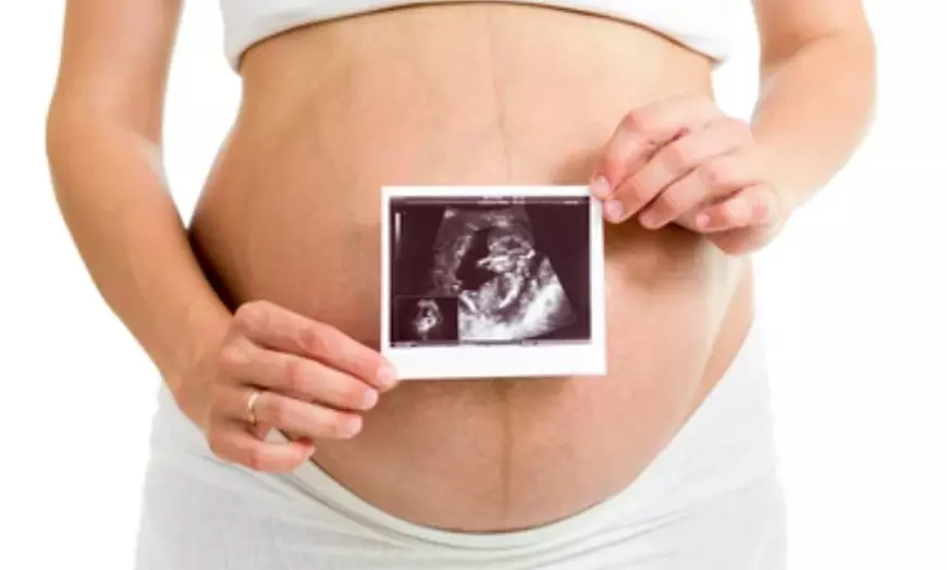 Image 1: Early Baby Scan, Gender Reveal Scan, or 4D HD Live Bonding Scan