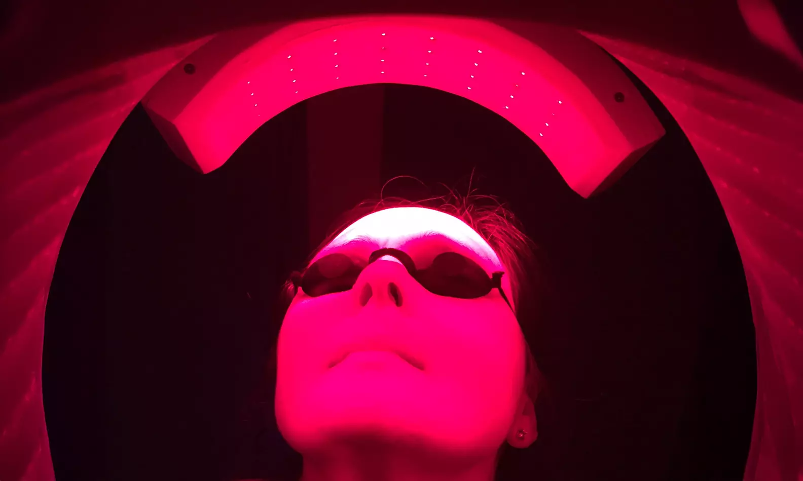 Extraction with Optional Microderm, Enzyme Peel, and/or High Frequency