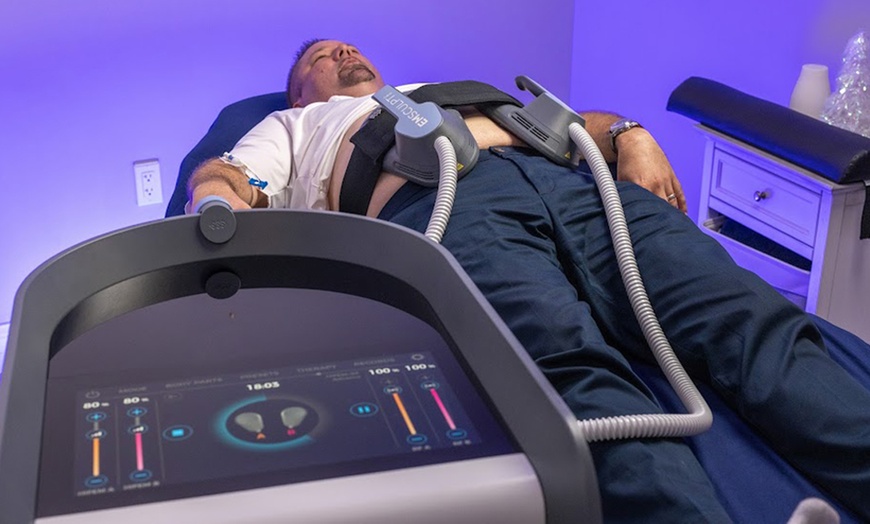 Image 4: Up to 56% Off on Fat Reduction - Non-Branded at iCRYO Stuart