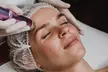 Limpieza facial básica o profunda con opción a diferentes tratamientos para 1 persona, ahorra hasta un 67% - Second Medium